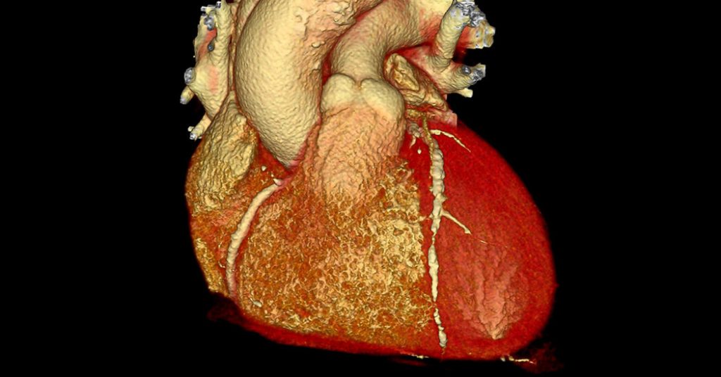 New Gene Editing Treatment Cuts Dangerous Cholesterol in Small Study