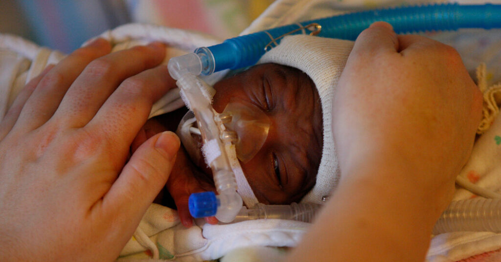 Premature Births Rose in the U.S. After Years of Decline, New Data Shows